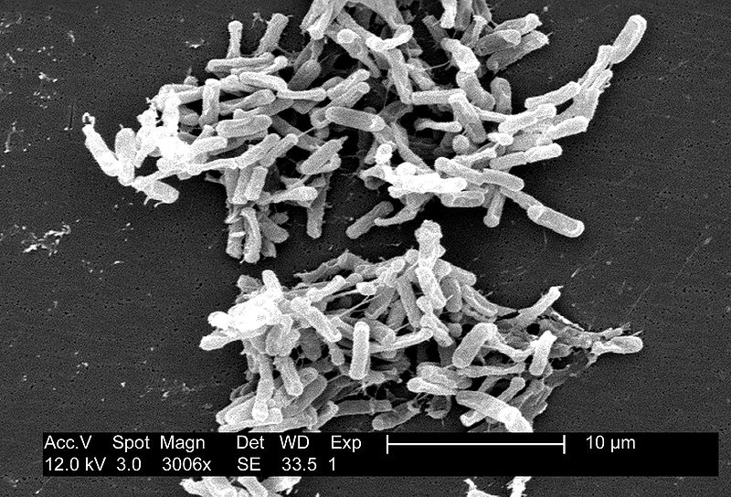 Clostridium colony from a stool sample